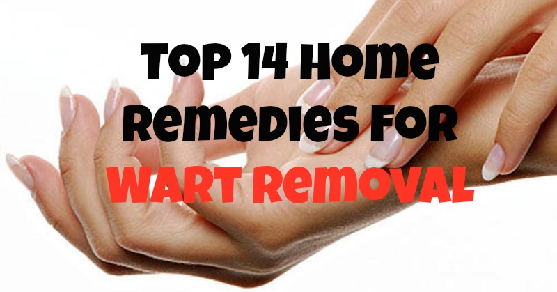 2 Home Remedies for Removing Warts – Best Wart Removal Medicine