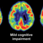 The Phenomenal Hobby that Reduces Alzheimer’s and Dementia by 50%