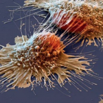 A Groundbreaking Program to Reverse and Prevent Cancer